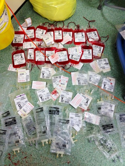 IMG_0001 major haemorrhage